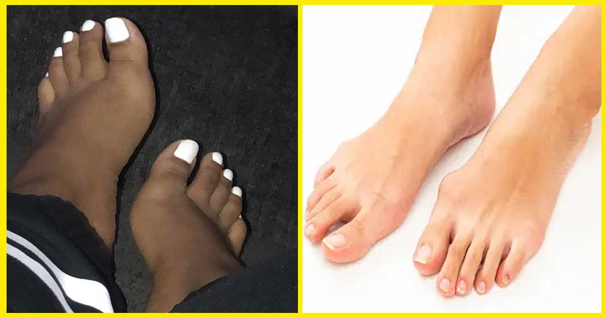 Black-&-white-feet