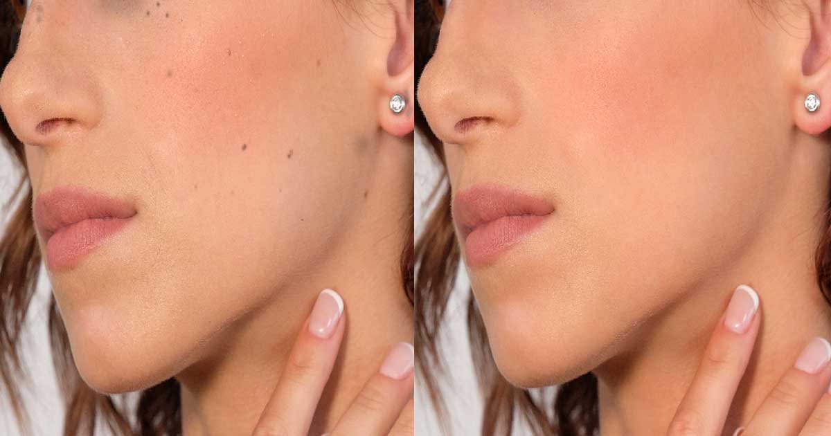Basic-Retouch