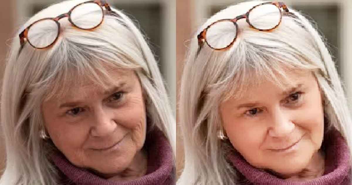 Facial-wrinkle-removal