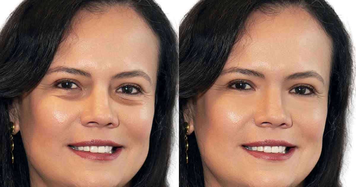 Maternity-under-eyes-bug-retouch